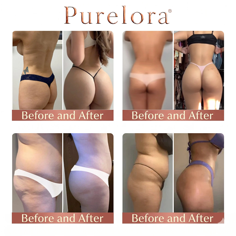 💖Purelora® CurveSculpt Micro-Patch ✦ Sculpt • Firm • Smooth Lower Body Curves ✦ Micro-Needle Infusion System