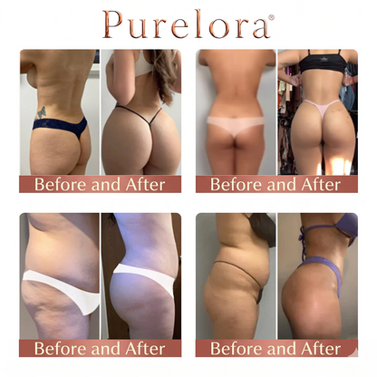 💖Purelora® CurveSculpt Micro-Patch ✦ Sculpt • Firm • Smooth Lower Body Curves ✦ Micro-Needle Infusion System