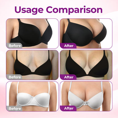 Bodylure® 🔥The Most Popular Product Among European and American Women in 2026
